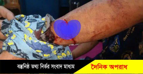 রাজনগরে পূর্ব বিরোধের জেরে হামলা আহত-২