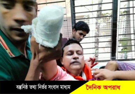 কুষ্টিয়ায় দিনে দুপুরে কলেজ শিক্ষকের হাতের কব্জি কেটে নিল দুর্বৃত্তরা