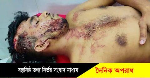 সেনবাগে ছাত্রলীগ নেতাকে কুপিয়েছে দুর্বৃত্তরা