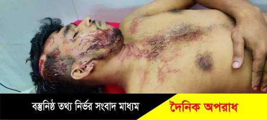 সেনবাগে ছাত্রলীগ নেতাকে কুপিয়েছে দুর্বৃত্তরা