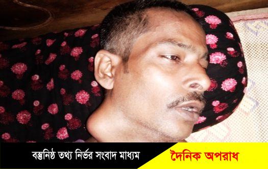 মরনব্যাধি ক্যান্সারে আক্রান্ত শয্যাসায়ী আলী হোসেনকে বাঁচাতে এগিয়ে আসুন৷ 