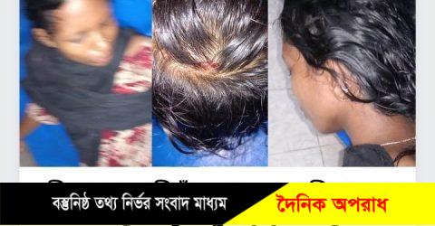 নবীগঞ্জের বাড়ীগাঁওয়ে গভীররাতে গৃহবধূর উপর সন্ত্রাসী হামলা চালিয়ে নির্মম নির্যাতন৷ আশংকাজনক অবস্থায় সিলেট ওসমানীকে প্রেরণ৷ 